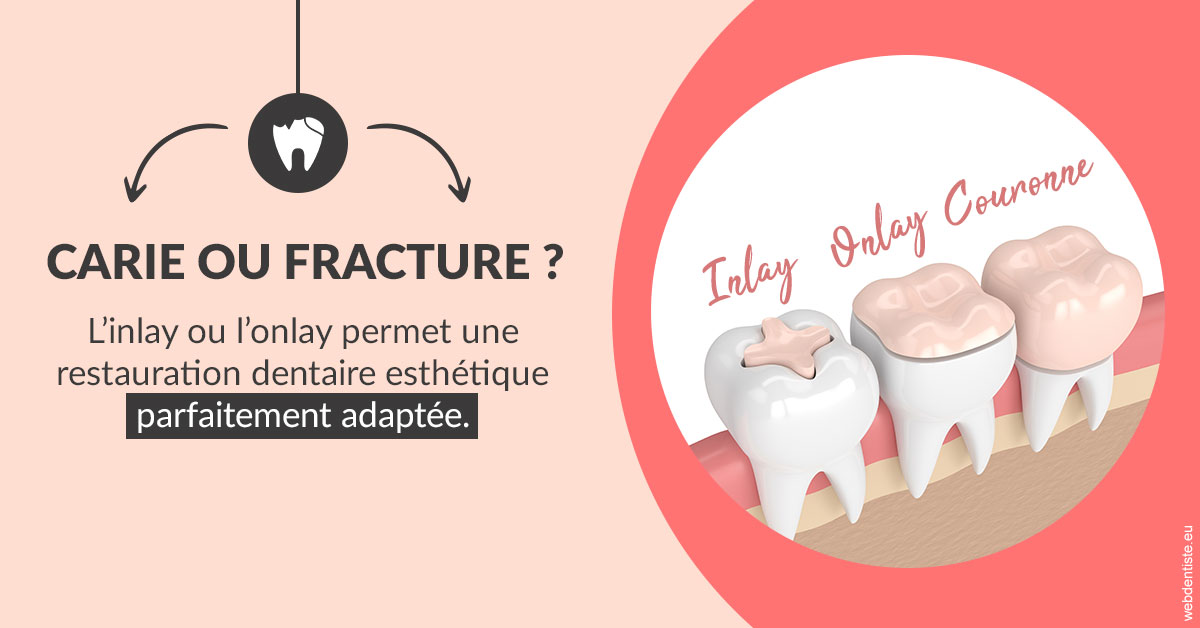 https://www.orthosante.be/T2 2023 - Carie ou fracture 2
