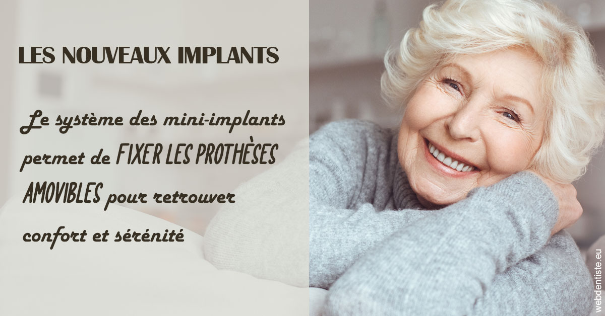 https://www.orthosante.be/Les nouveaux implants 1