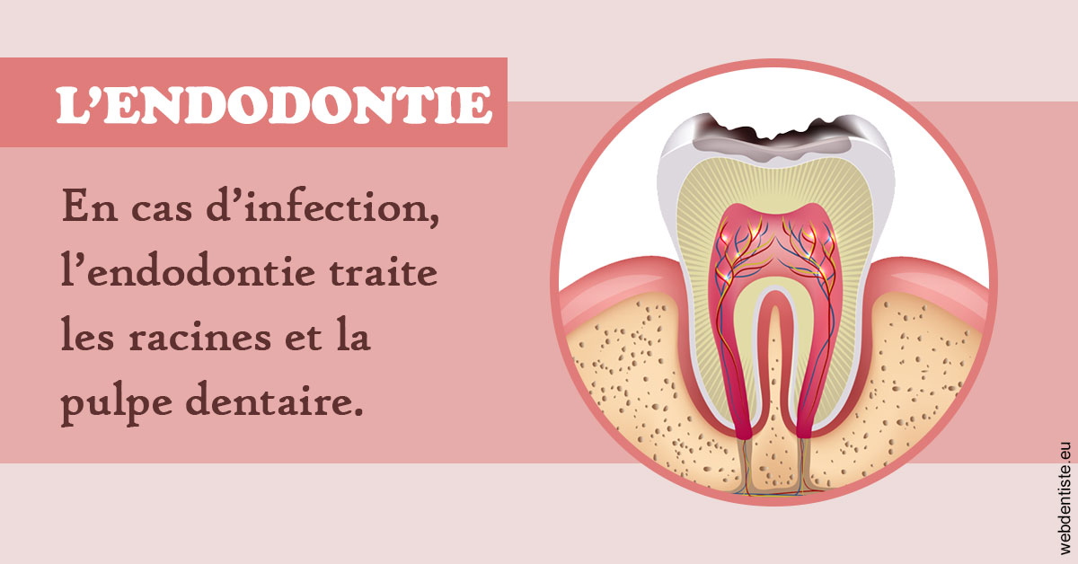 https://www.orthosante.be/L'endodontie 2
